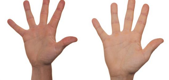 volunteer-422598_640